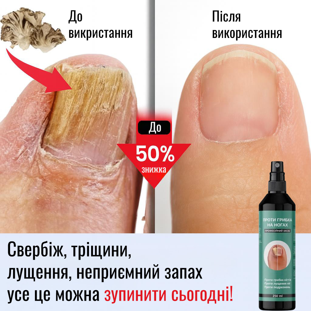 Засіб проти грибка на ногах FungiStop