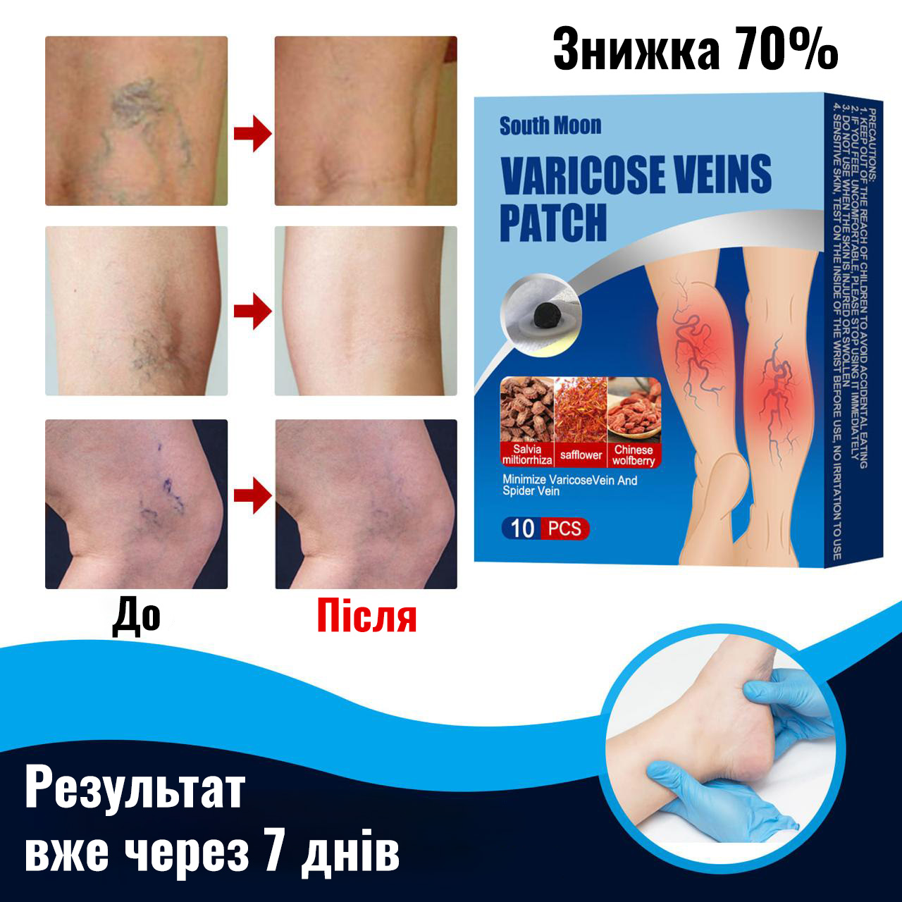Патчі від варикозу